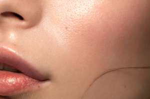 Clear Skin Beauty