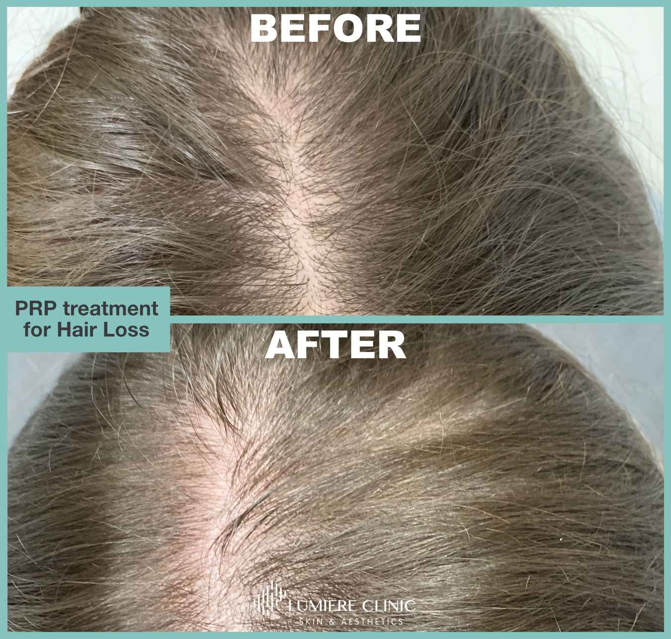 Hair Loss Treatment Manchester, Cheshire & Lancashire | Dr Nicole Dermatology Hair Loss Treatment Manchester, Cheshire & Lancashire | Dr Nicole Dermatology
