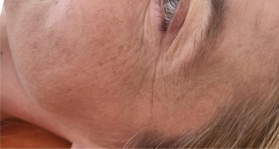 Dr Nicole Dermatology | Manchester | Warrington | Cheshire
