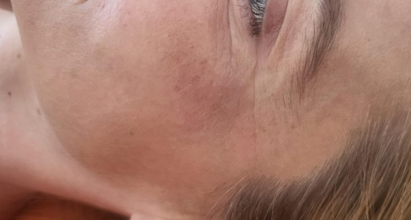 Dr Nicole Dermatology | Manchester | Warrington | Cheshire