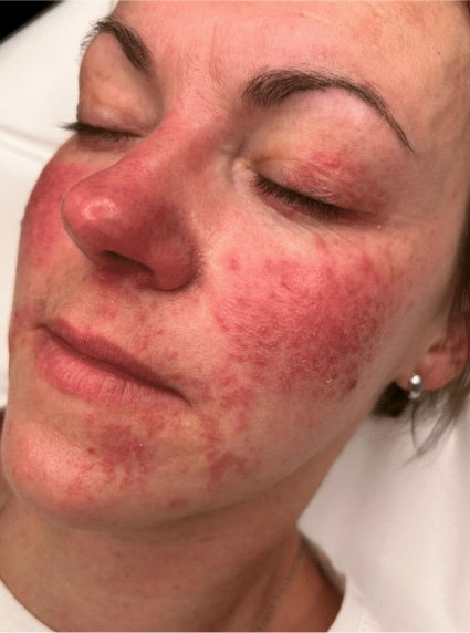 Dr Nicole Dermatology | Manchester | Warrington | Cheshire