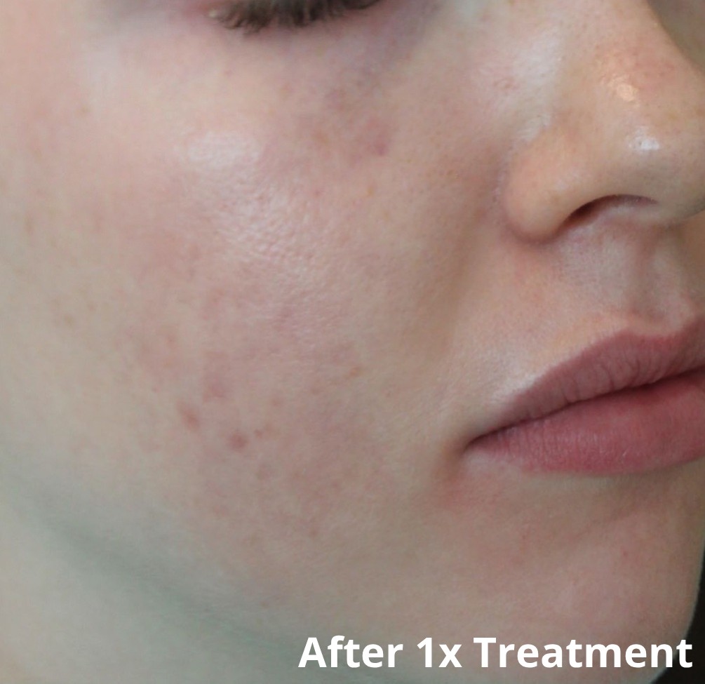 Dr Nicole Dermatology | Manchester | Warrington | Cheshire