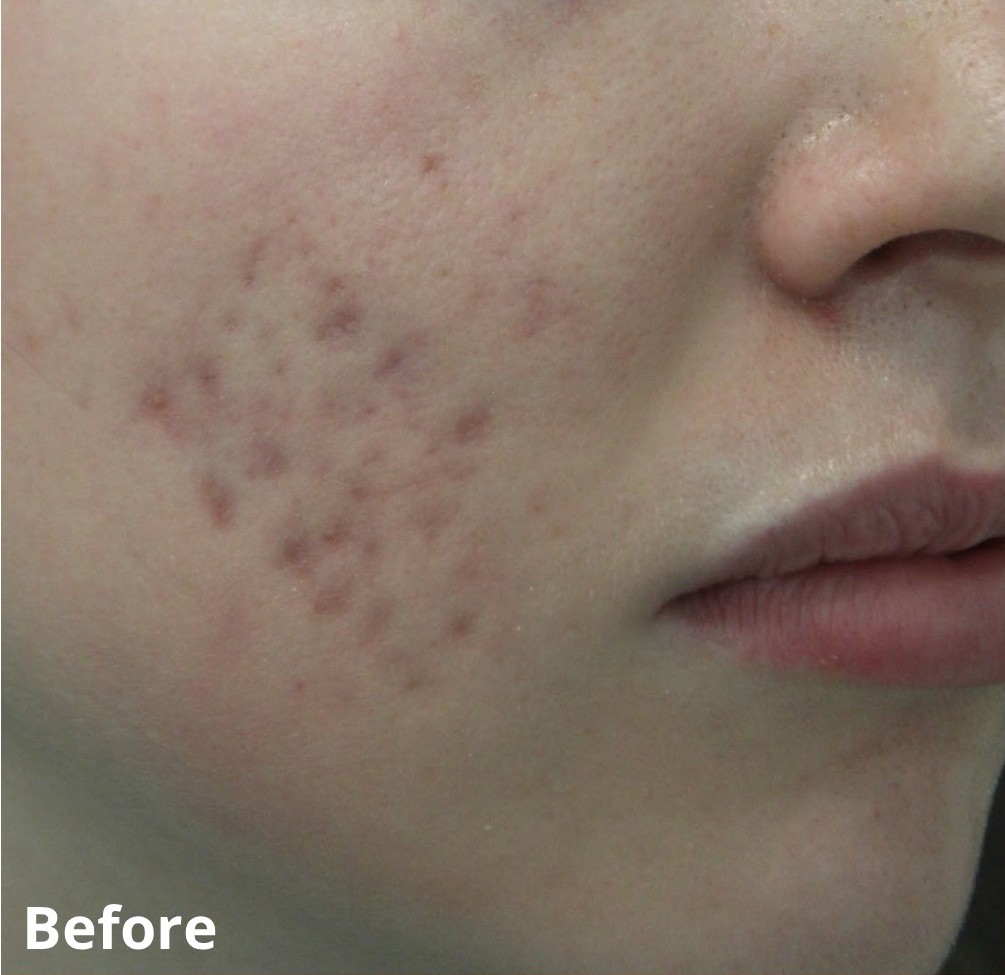 Dr Nicole Dermatology | Manchester | Warrington | Cheshire