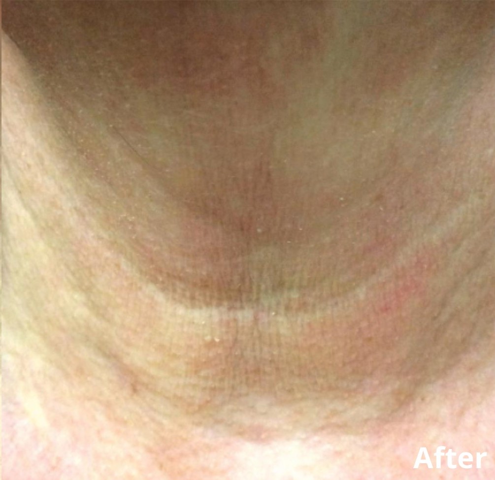 Dr Nicole Dermatology | Manchester | Warrington | Cheshire