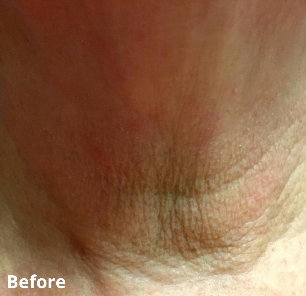 Dr Nicole Dermatology | Manchester | Warrington | Cheshire