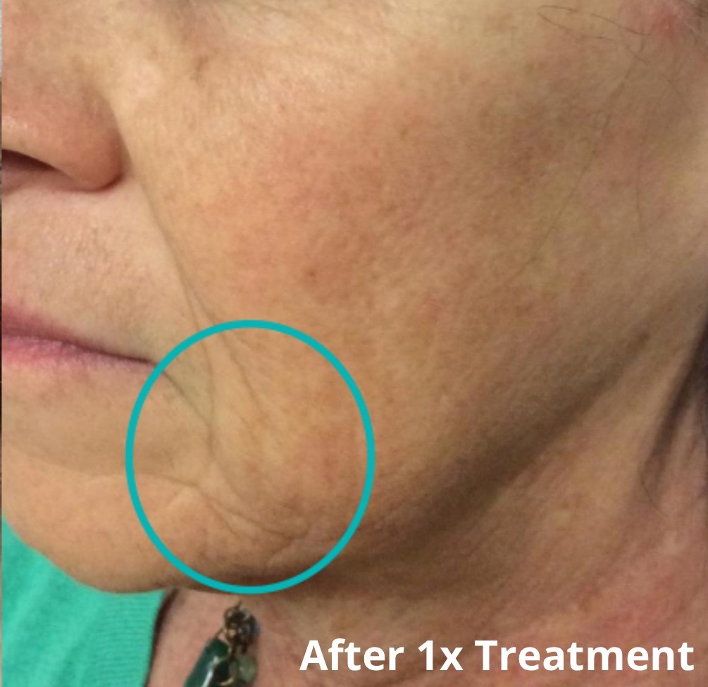 Dr Nicole Dermatology | Manchester | Warrington | Cheshire