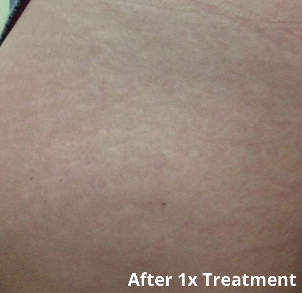 Dr Nicole Dermatology | Manchester | Warrington | Cheshire