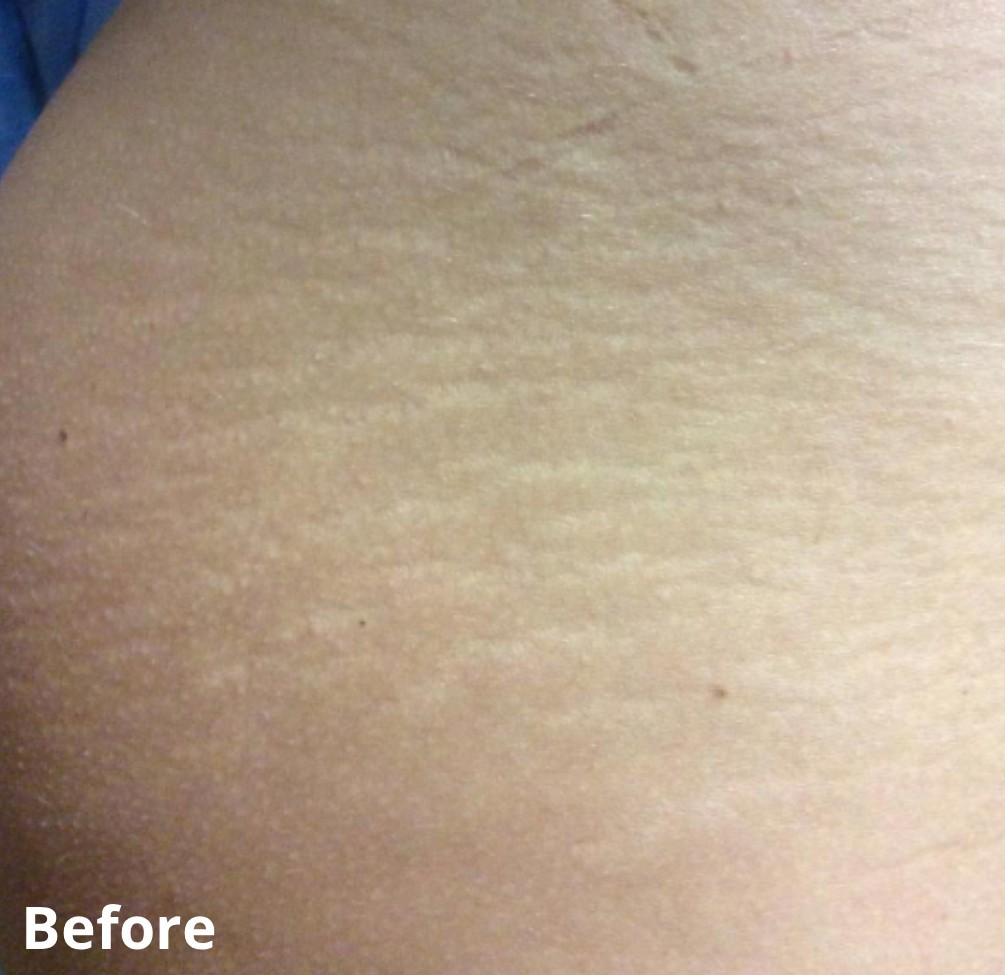 Dr Nicole Dermatology | Manchester | Warrington | Cheshire